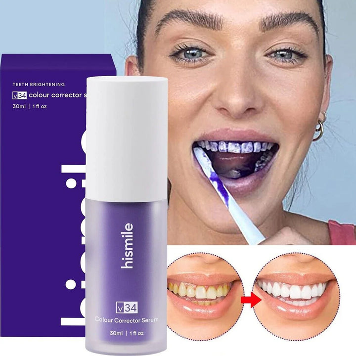 Blanqueador Dental V34 HiSmile™